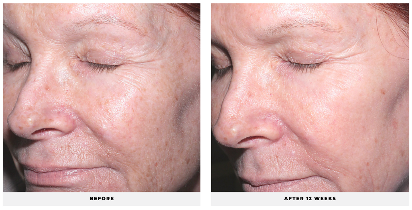 Advanced Retinol - CosMedical Technologies