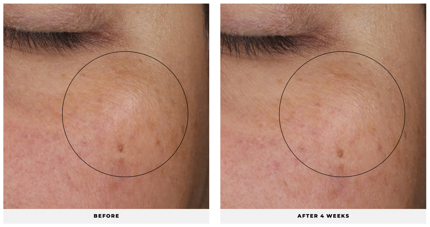 Complexion Renewal Oil