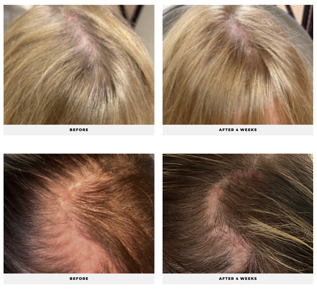 Revitalize + Restore Microbiome Shampoo