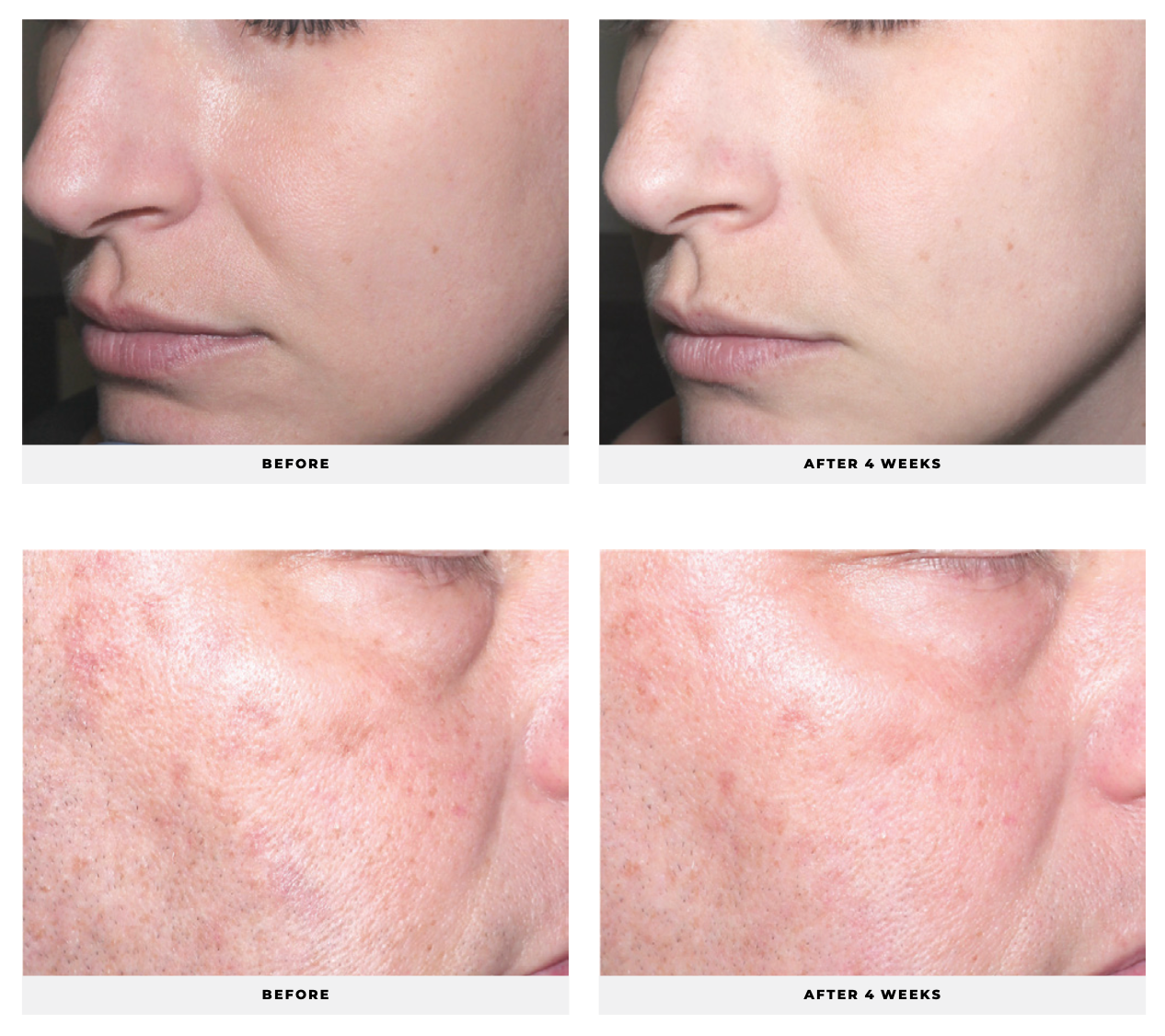Skin Brightening System