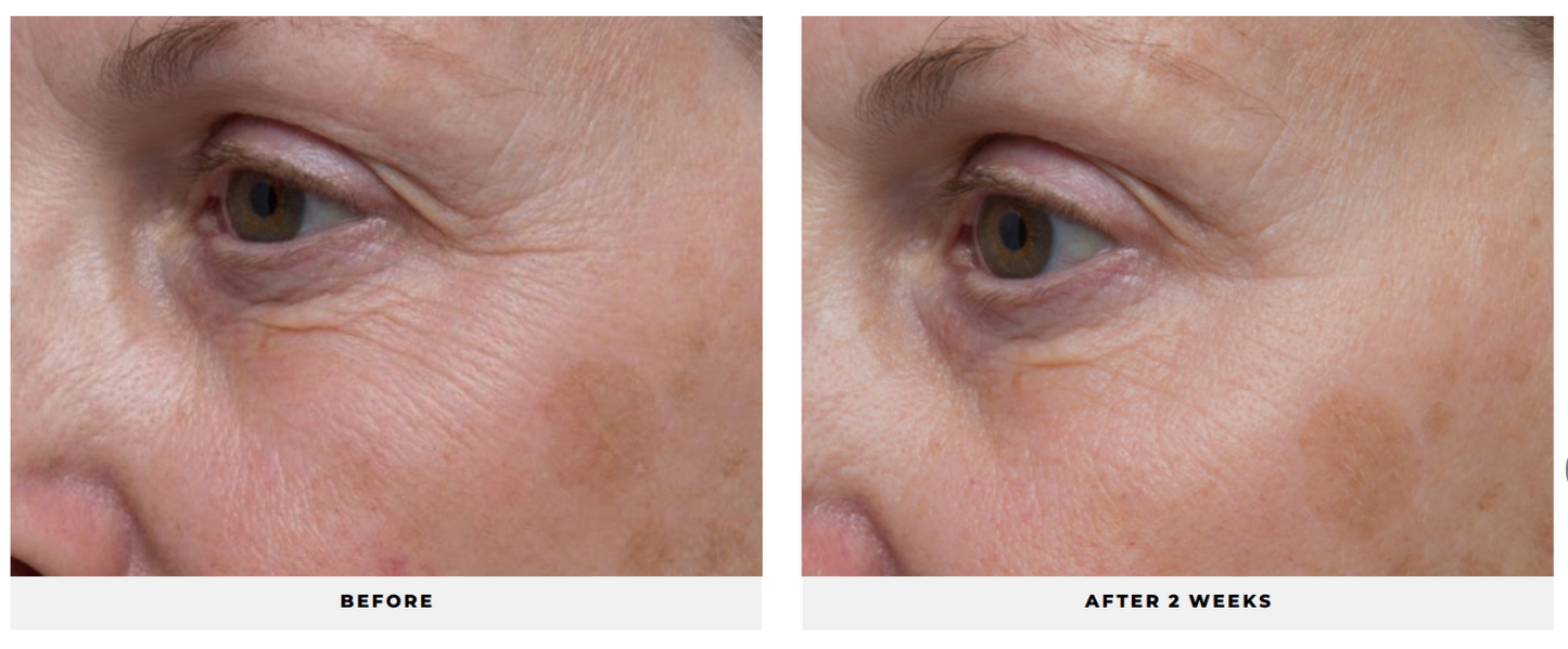 Ultra Benefits® Eye Gel