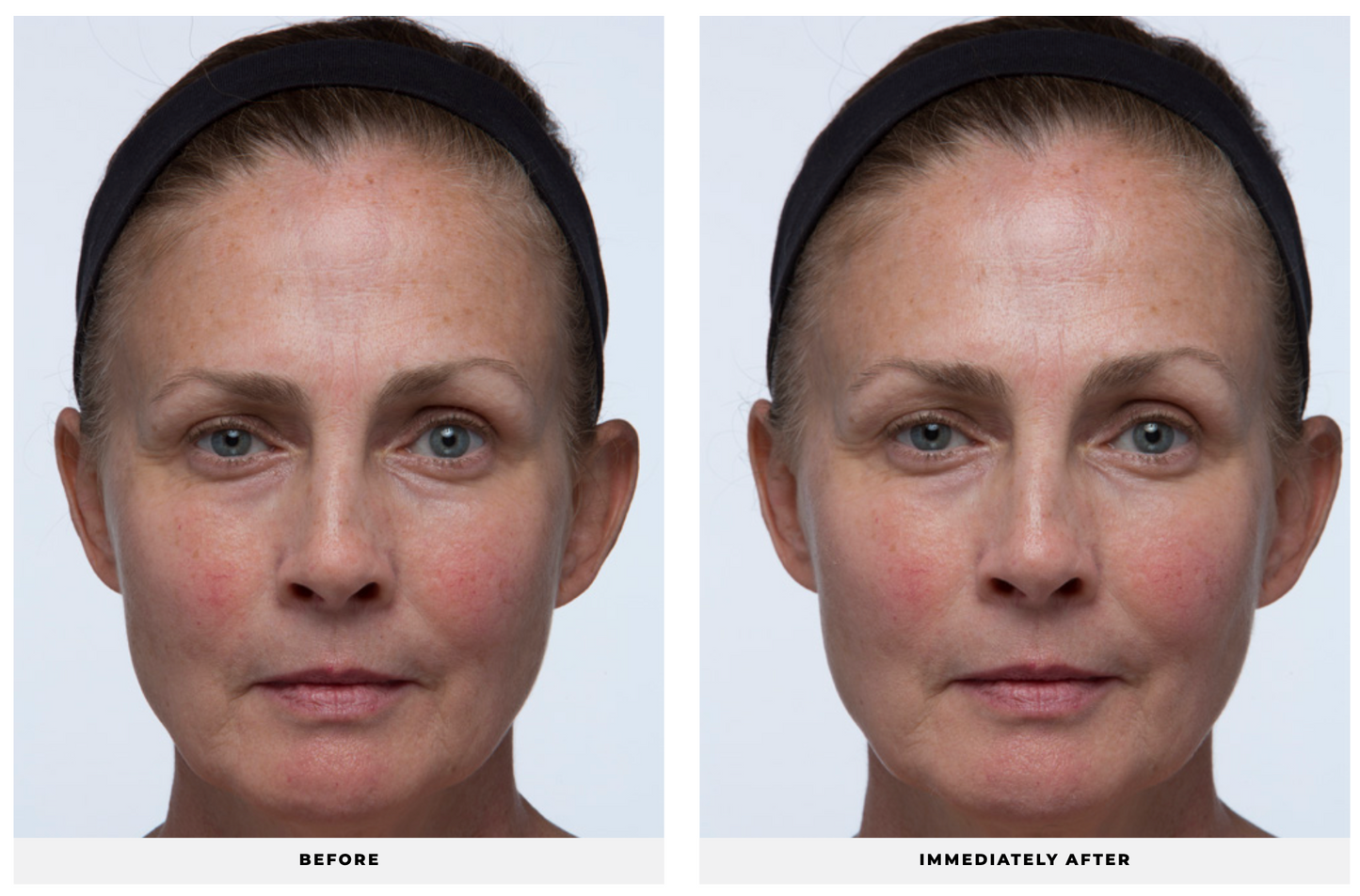 Ultra Replenishing Sunscreen SPF 40