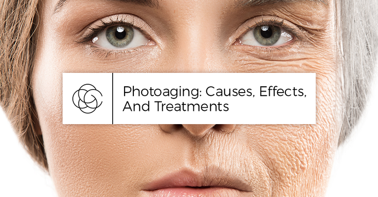 Photoaging: Causes, Effects, And Treatments