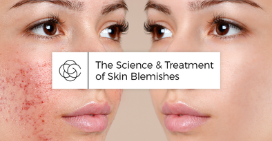 The Science & Treatment of Skin Blemishes