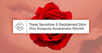 Treat Sensitive & Reddened Skin this Rosacea Awareness Month