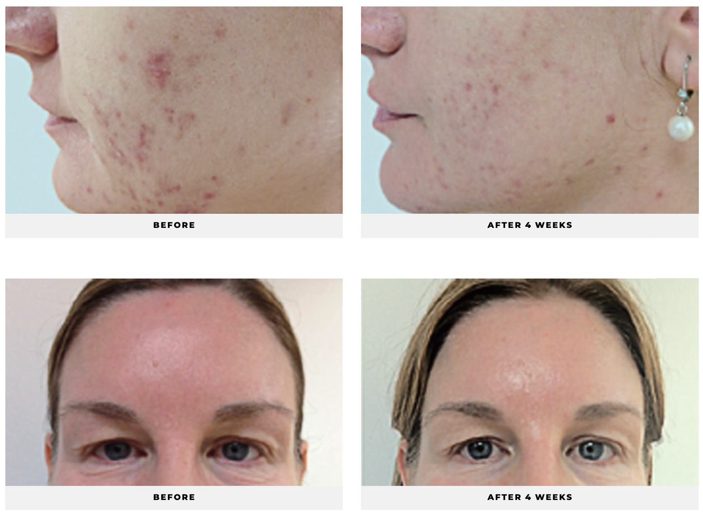 Green Tea Antioxidant Serum