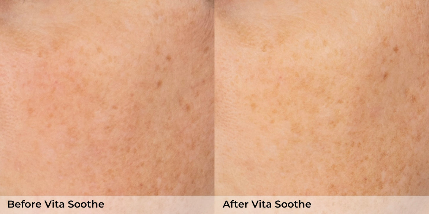 Vita Soothe