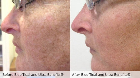 Ultra Benefits® - CosMedical Technologies
