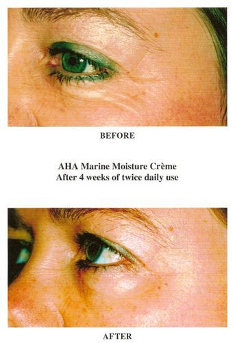 AHA Marine Moisture Crème 50ML Tester - CosMedical Technologies