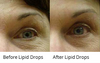 Lipid Drops 30ML Tester - CosMedical Technologies
