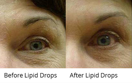 Lipid Drops 30ML Tester - CosMedical Technologies