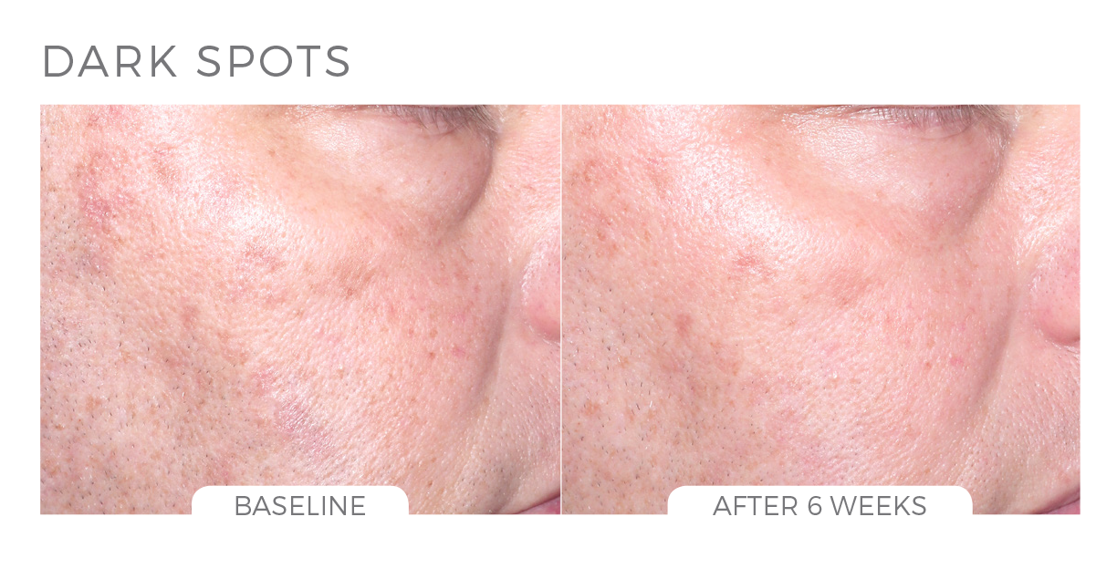 Skin Brightening System - CosMedical Technologies
