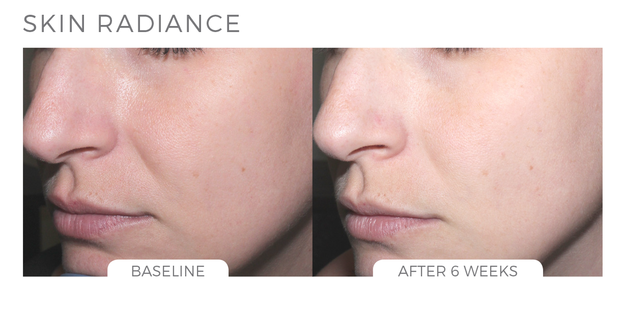 Skin Brightening System - CosMedical Technologies