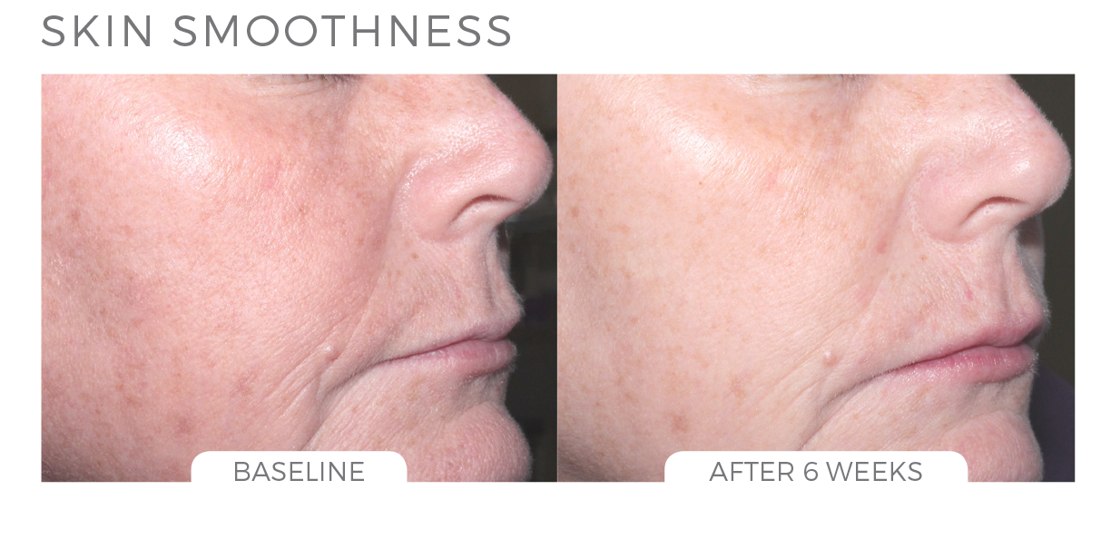 Skin Brightening System - CosMedical Technologies