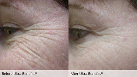Ultra Benefits® 50ML Tester - CosMedical Technologies